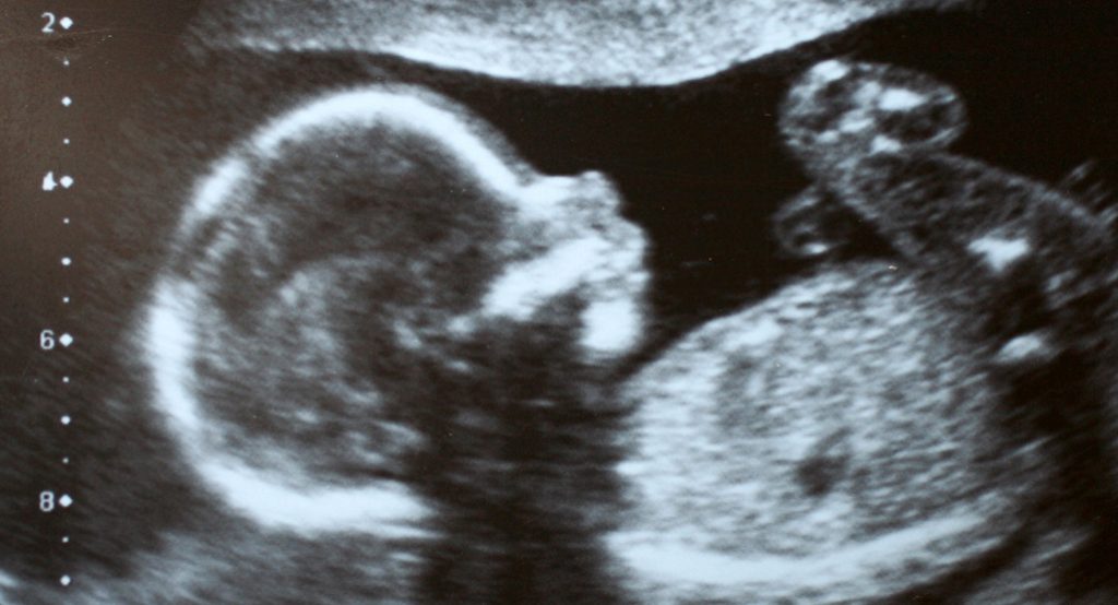 TIFFA Scan in Routine Care